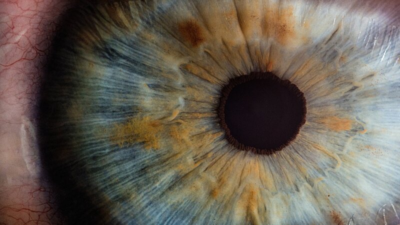 Diagnose Diabetische Retinopathie – So verbessern Sie Ihr Kontrastsehen